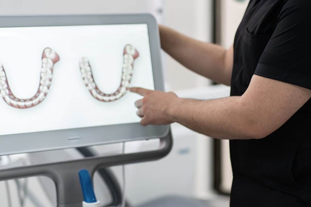 what-is-a-wellness-scan-how-the-itero-scanner-enhances-your-dental-visit