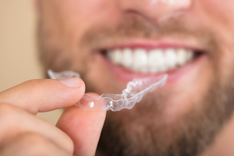 When Will You See Results From Invisalign?